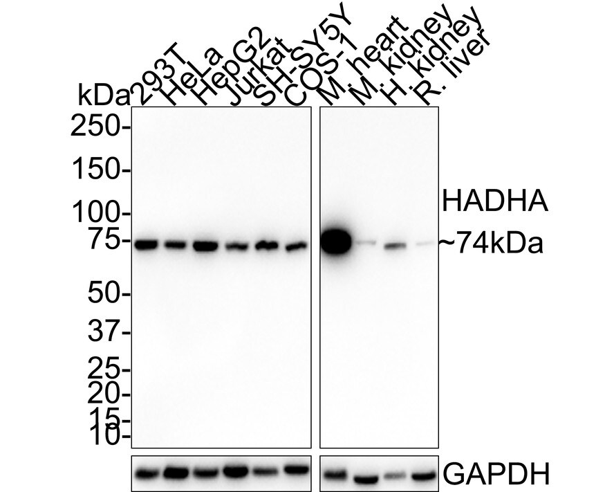 HADHA Antibody (PSH01-28) Western Blot: HADHA Antibody (PSH01-28) [NBP3-32414]