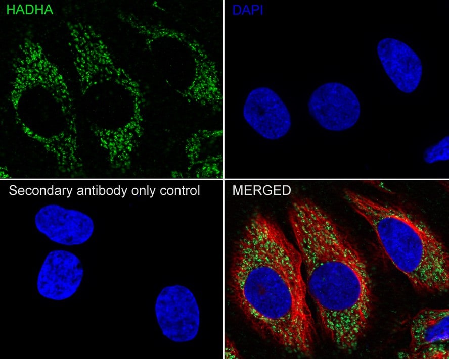 HADHA Antibody (PSH01-28)