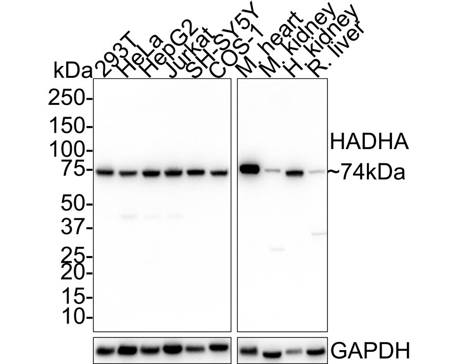 HADHA Antibody (PSH01-29) Western Blot: HADHA Antibody (PSH01-29) [NBP3-32415]