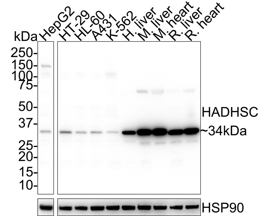 HADH Antibody (D10-E7-R) Western Blot: HADH Antibody (D10-E7-R) [NBP3-32416]