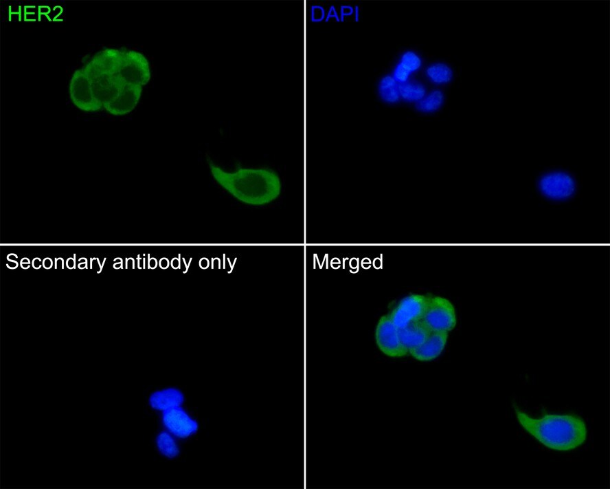 ErbB2/Her2 Antibody (PD00-53)