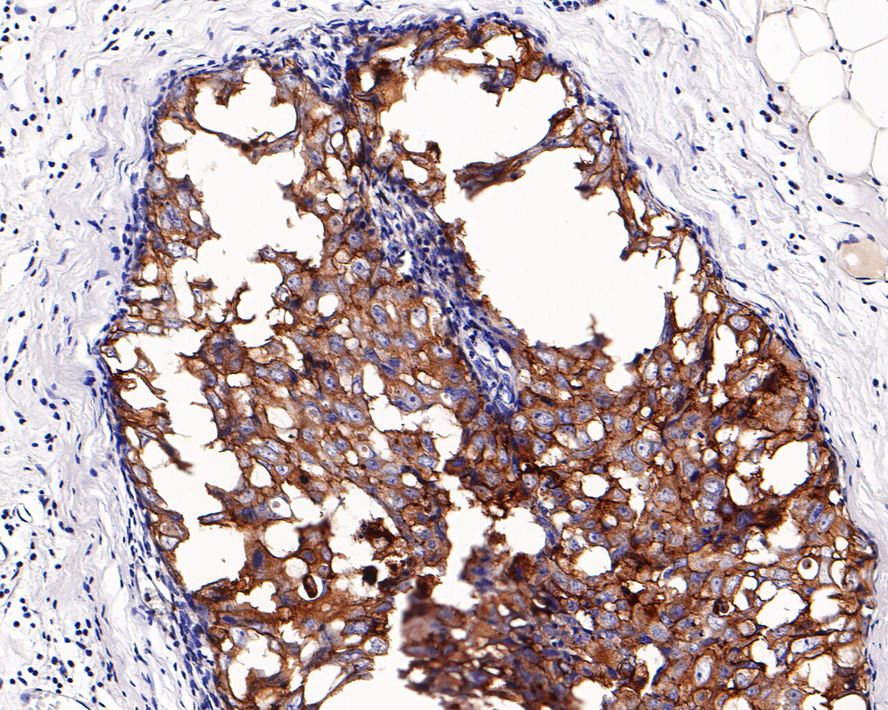 ErbB2/Her2 Antibody (PD00-53)