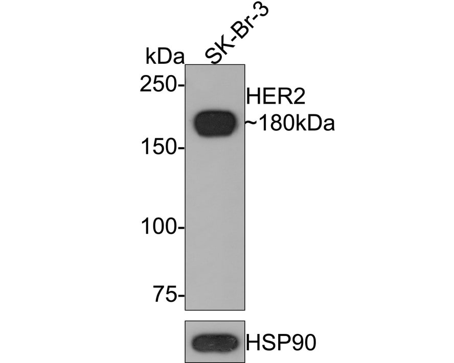 ErbB2/Her2 Antibody (PD00-99)