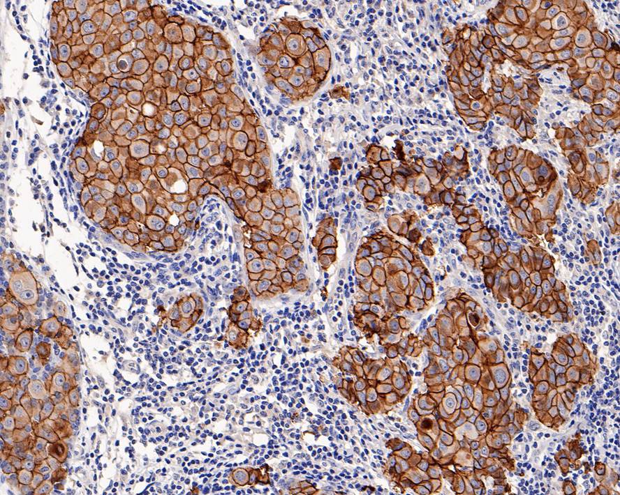 ErbB2/Her2 Antibody (PD00-99)