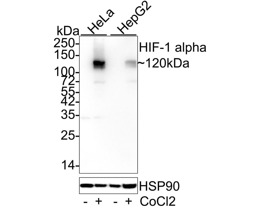 HIF-1 alpha Antibody (JE75-33)