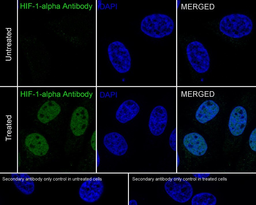 HIF-1 alpha Antibody (JE75-33)