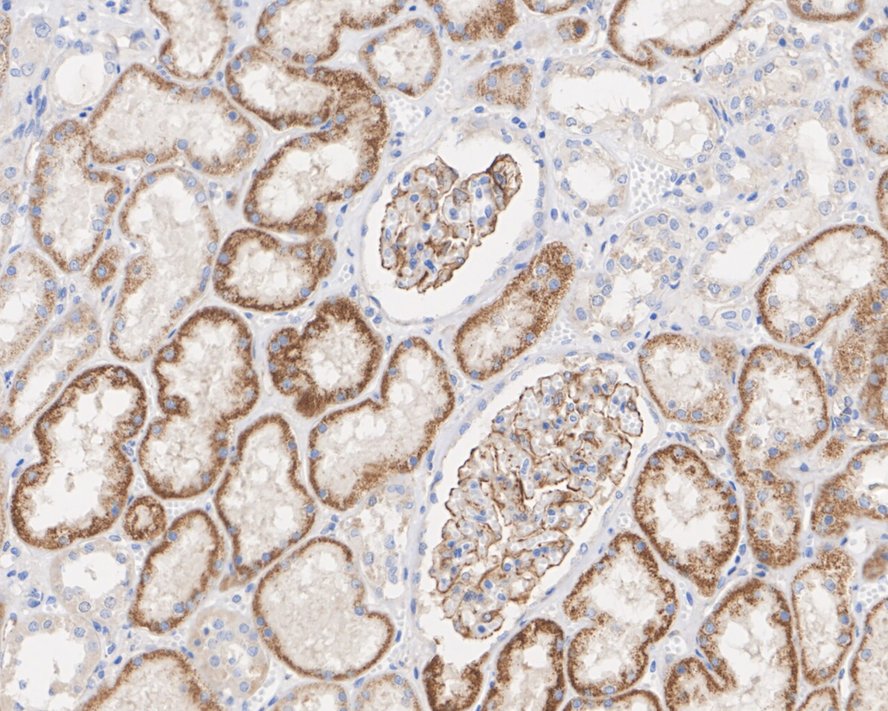HIF-1 alpha Antibody (JE75-33)