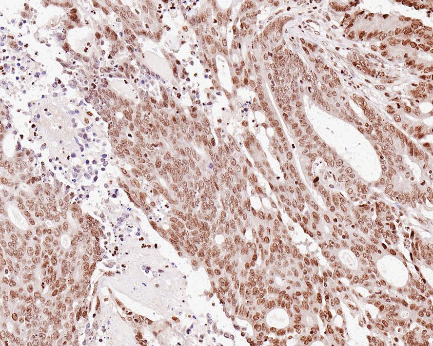 Histone H2a [ac Lys9] Antibody (PS01-45)
