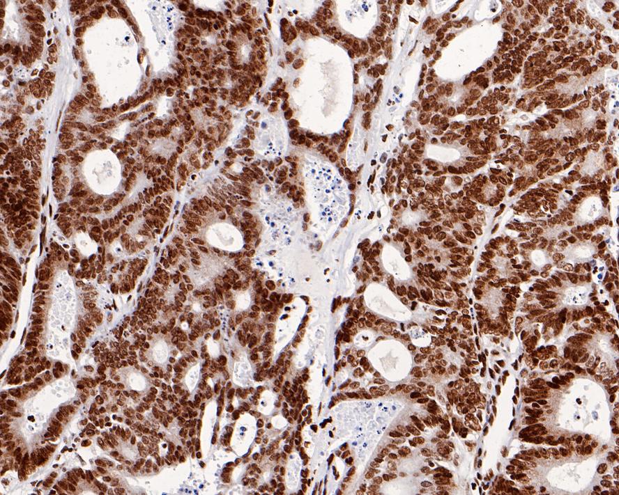 Histone H2B [ac Lys20] Antibody (PS01-46)