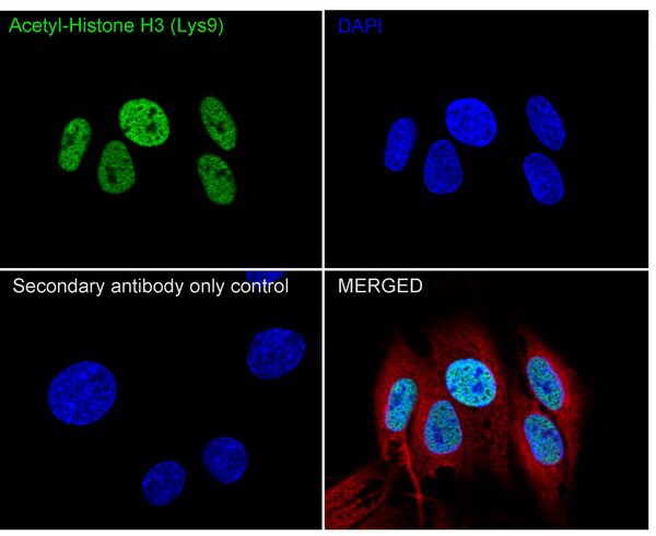 Histone H3 [ac Lys9] Antibody (PSH04-47)