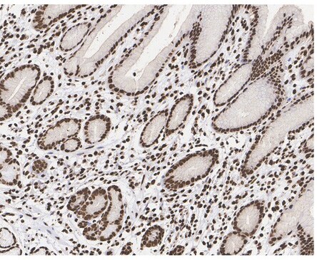 Histone H3 [ac Lys9] Antibody (PSH04-47)