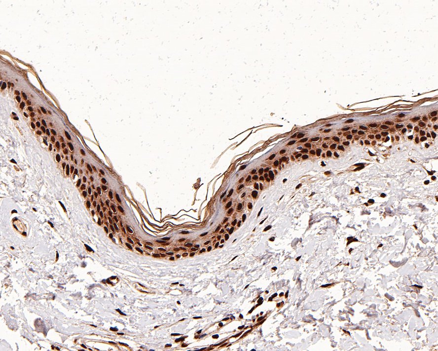 Histone H4 [ac Lys8] Antibody (PS01-25)