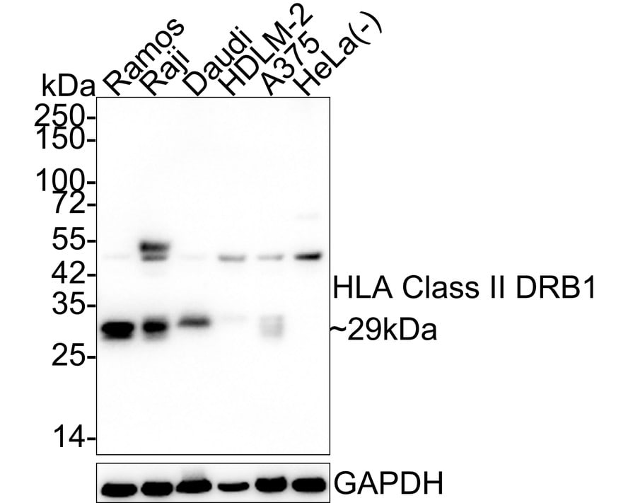 HLA DRB1 Antibody (JE60-43) Western Blot: HLA DRB1 Antibody (JE60-43) [NBP3-32433]