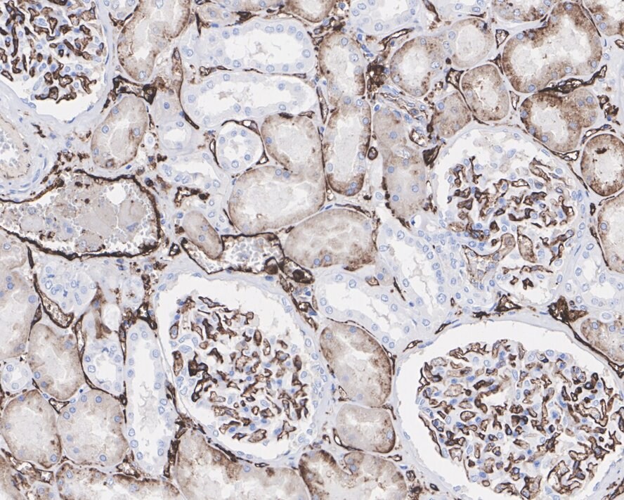 HLA-DR Antibody (10-D8-R)