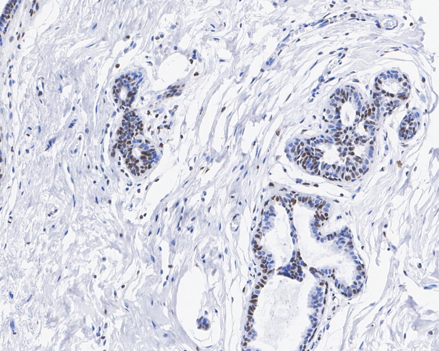 HMGB2 Antibody (JE52-82)