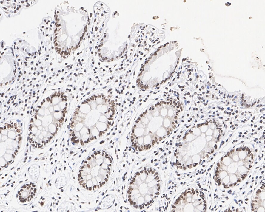 HNRNPA0 Antibody (PSH02-77)
