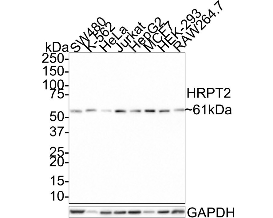 CDC73/HRPT2 Antibody (JE66-42) Western Blot: CDC73/HRPT2 Antibody (JE66-42) [NBP3-32442]