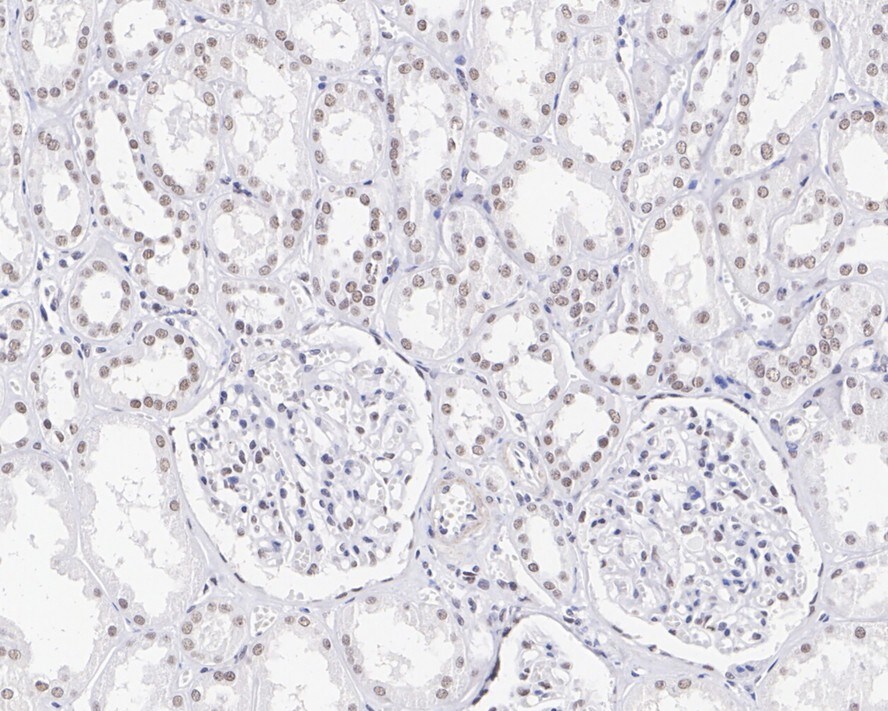 CDC73/HRPT2 Antibody (JE66-42)