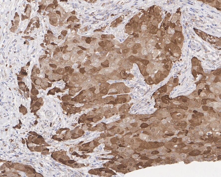 HSP70/HSPA1A Antibody (PD01-65)