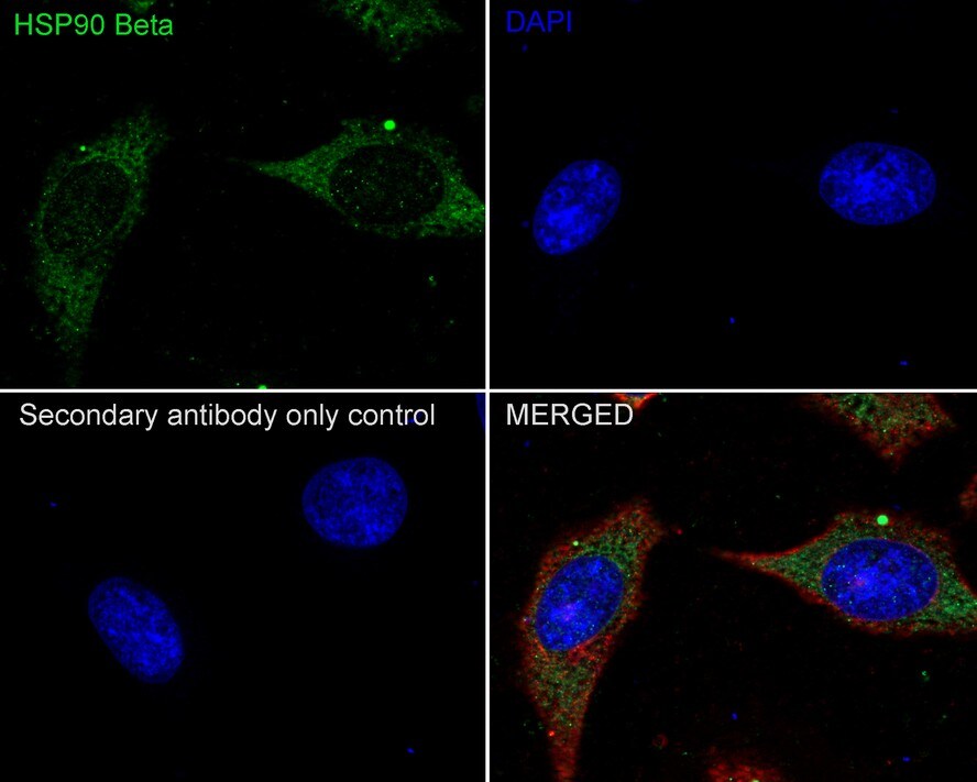 HSP90 beta Antibody (2-1-G3-R)