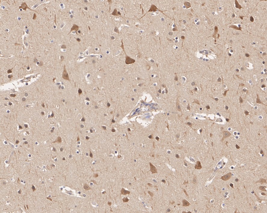 HSP90 beta Antibody (2-1-G3-R)