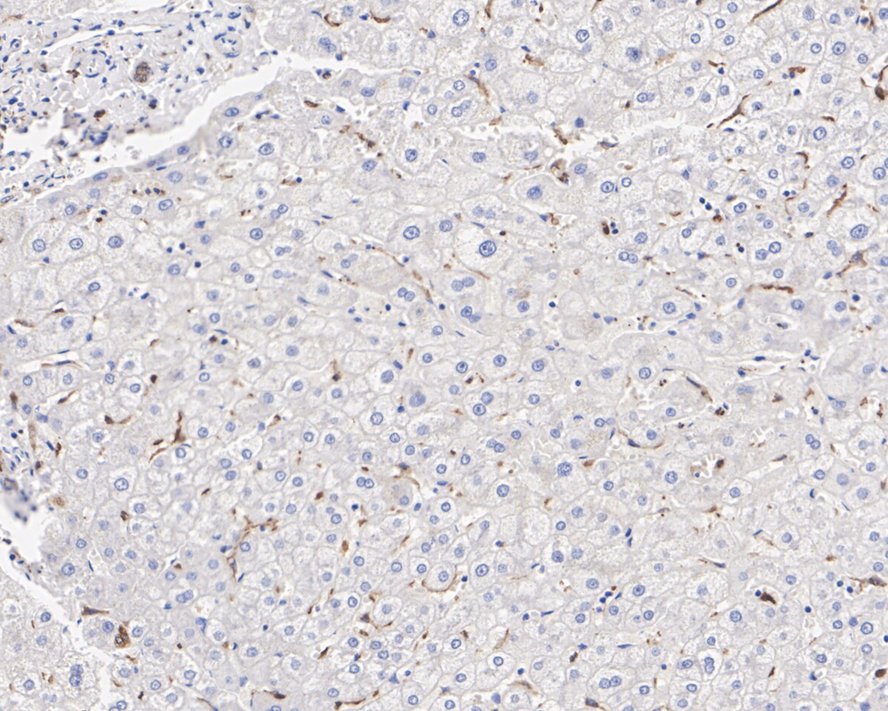 IL-18/IL-1F4 Antibody (PSH02-08)
