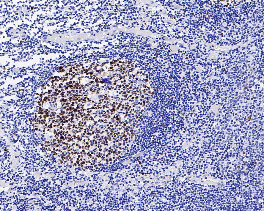 Ki67/MKI67 Antibody (PD00-10)