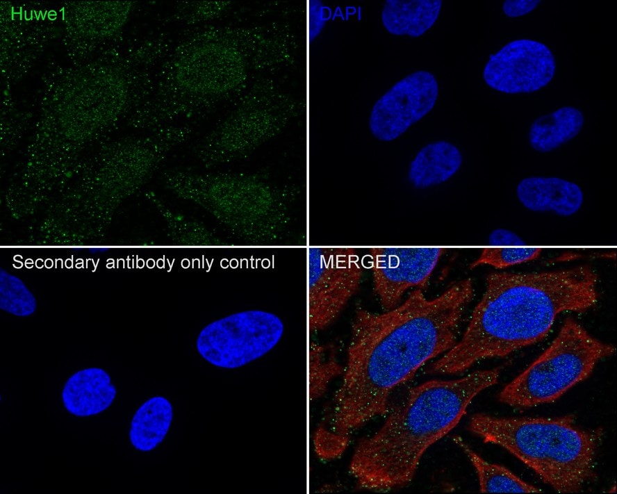 HUWE1 Antibody (PSH02-38)