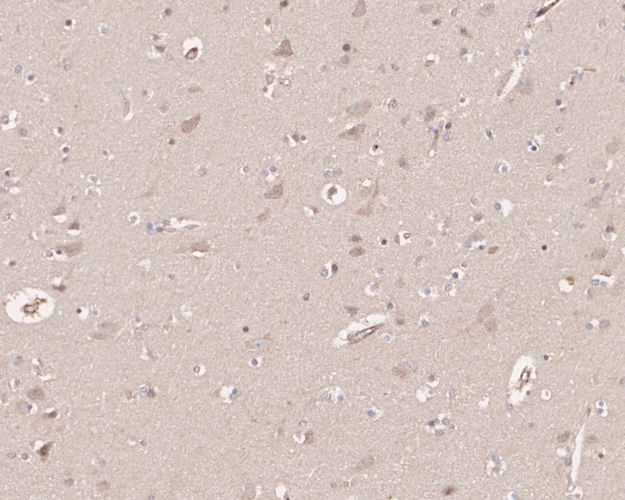 HUWE1 Antibody (PSH02-38)