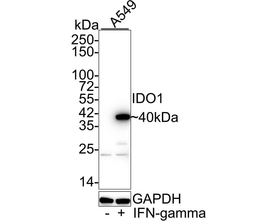 Indoleamine 2,3-dioxygenase/IDO Antibody (PD00-62)