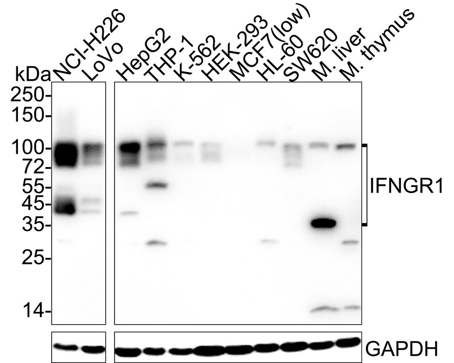 IFN-gamma R1/CD119 Antibody (JE40-50) Western Blot: IFN-gamma R1/CD119 Antibody (JE40-50) [NBP3-32458]