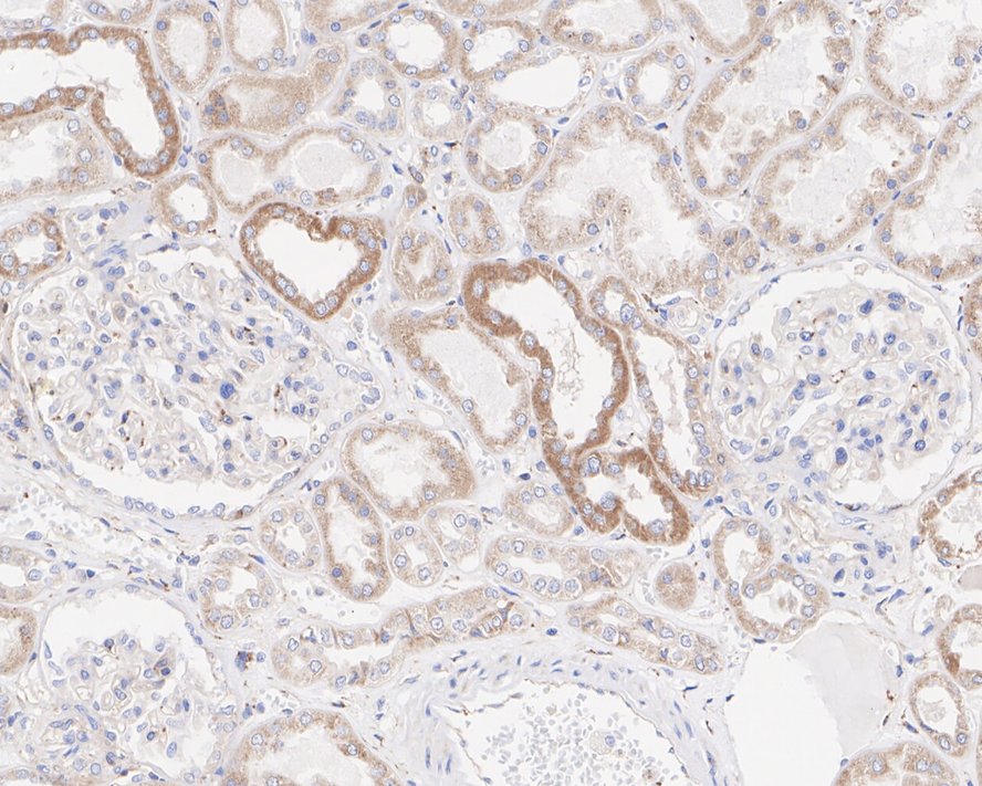 IFN-gamma R1/CD119 Antibody (JE40-50)