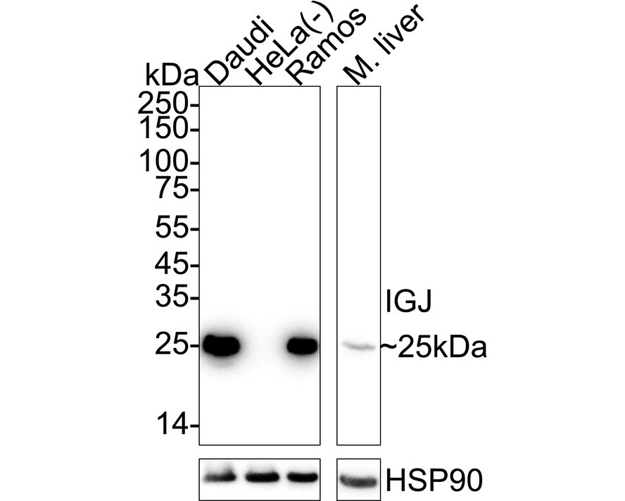IgJ Antibody (PD00-89) Western Blot: IgJ Antibody (PD00-89) [NBP3-32462]