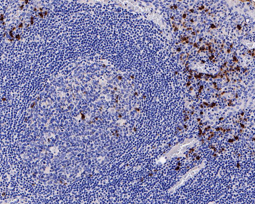 IgJ Antibody (PD00-89)
