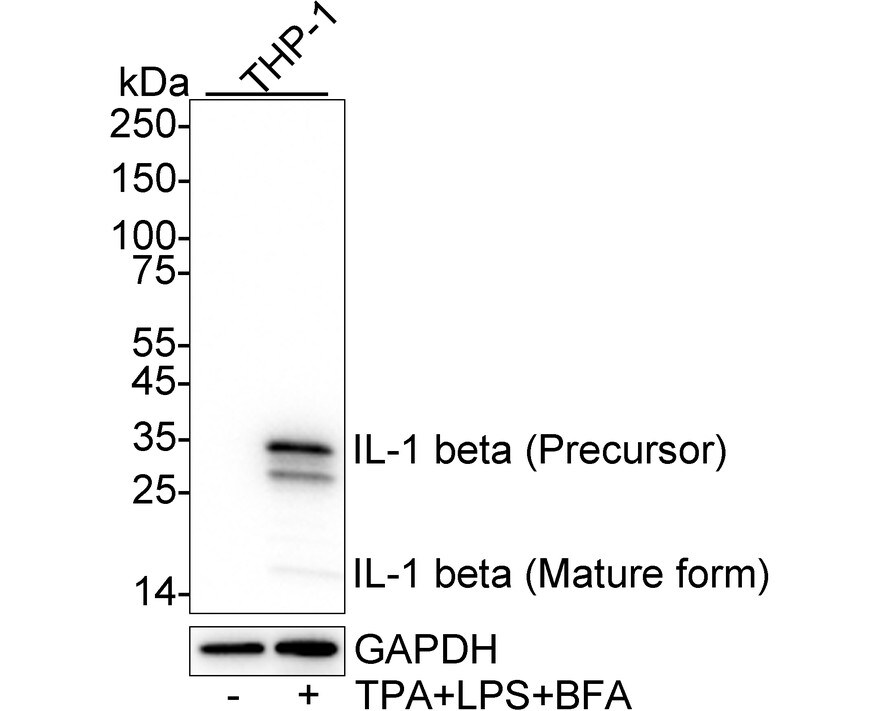 IL-1 beta/IL-1F2 Antibody (A7F7-R) Western Blot: IL-1 beta/IL-1F2 Antibody (A7F7-R) [NBP3-32464]