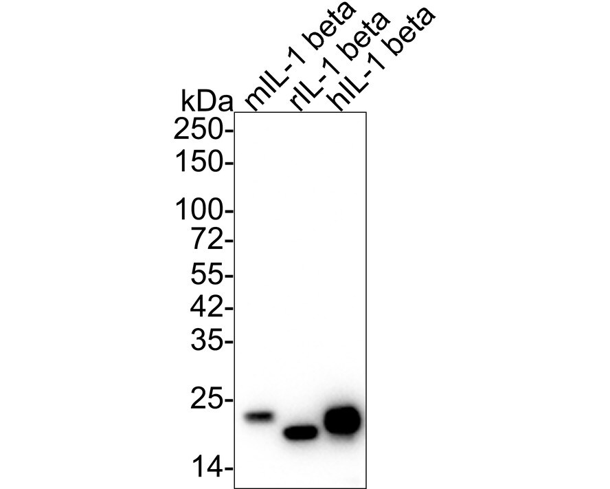 IL-1 beta/IL-1F2 Antibody (A7F7-R) Western Blot: IL-1 beta/IL-1F2 Antibody (A7F7-R) [NBP3-32464]