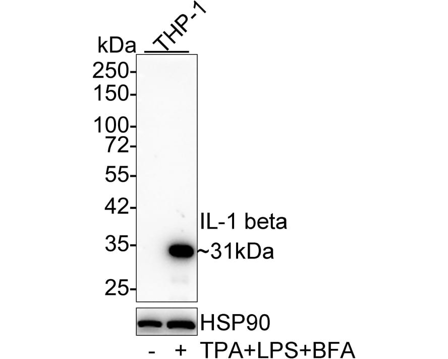 IL-1 beta/IL-1F2 Antibody (A7F7-R)