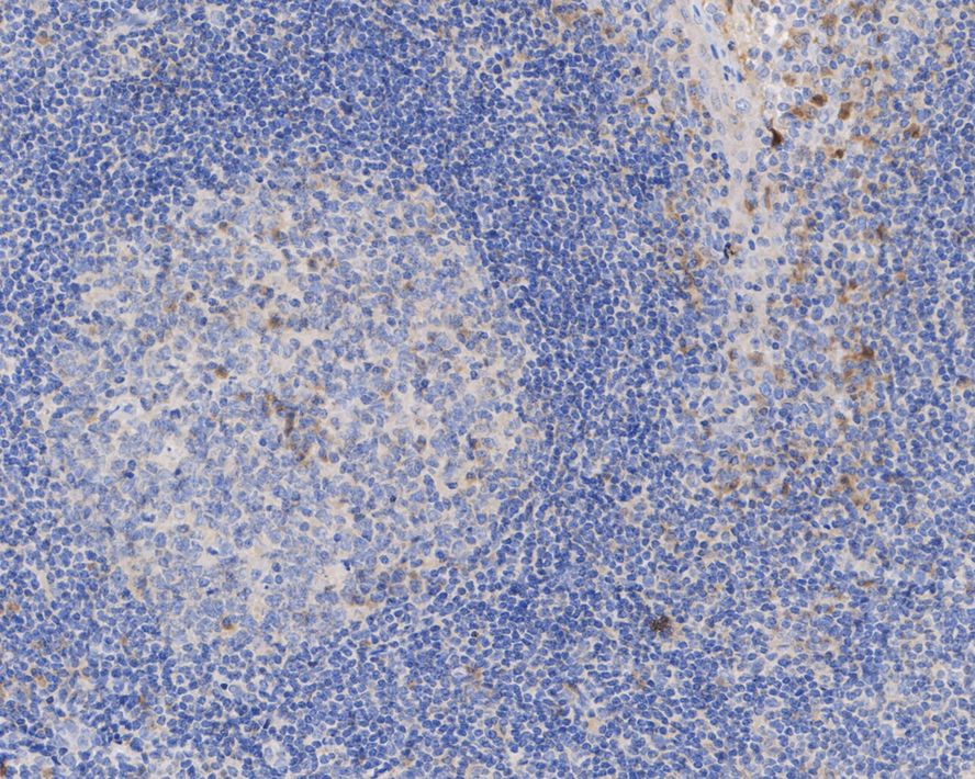 IL-1 beta/IL-1F2 Antibody (A7F7-R)