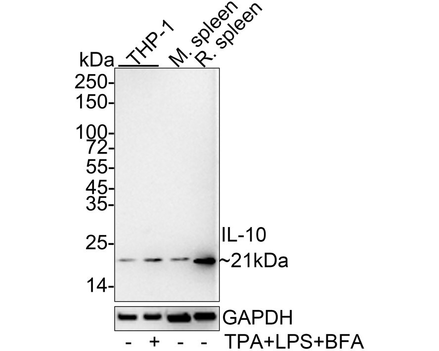 IL-10 Antibody (JE59-71) Western Blot: IL-10 Antibody (JE59-71) [NBP3-32465]