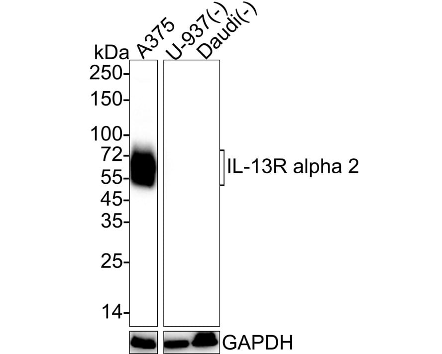 IL-13R alpha 2 Antibody (PSH03-85) Western Blot: IL-13R alpha 2 Antibody (PSH03-85) [NBP3-32466]
