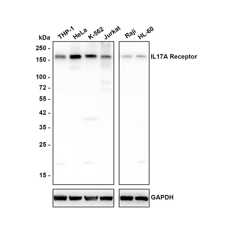IL-17RA/IL-17R Antibody (JE35-89) Western Blot: IL-17RA/IL-17R Antibody (JE35-89) [NBP3-32467]