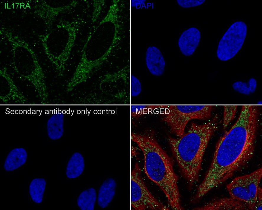 IL-17RA/IL-17R Antibody (JE35-89)