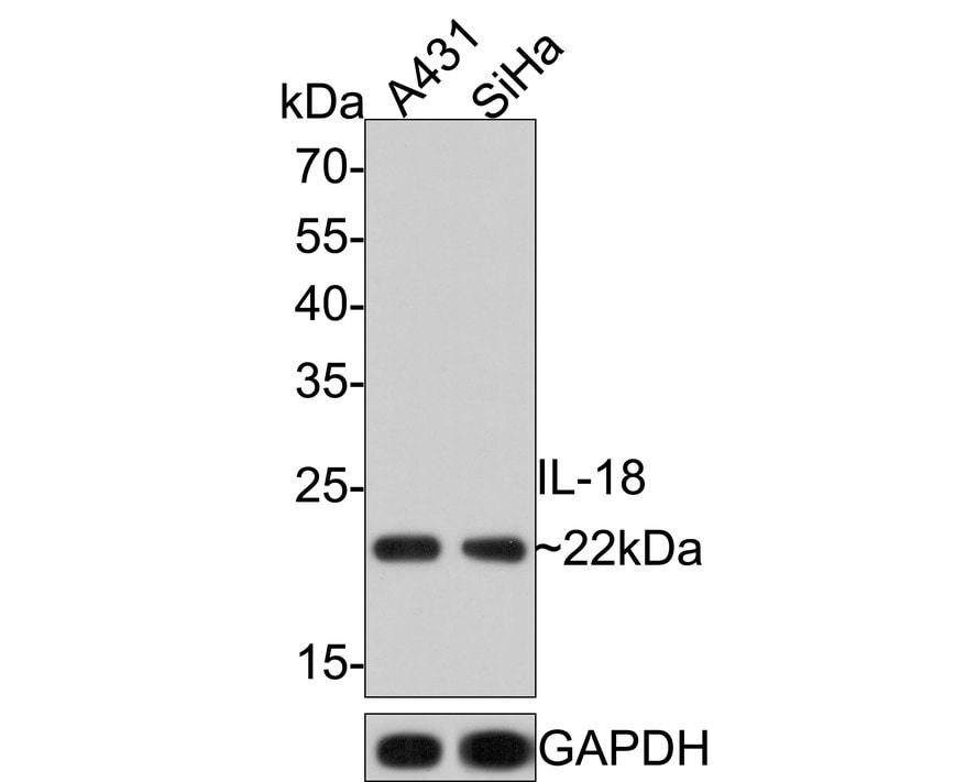 IL-18/IL-1F4 Antibody (PS00-41)