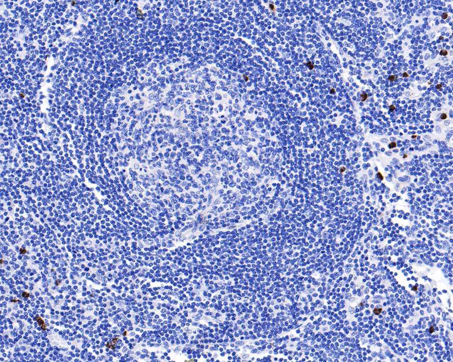 IL-23 Antibody (JE38-99)