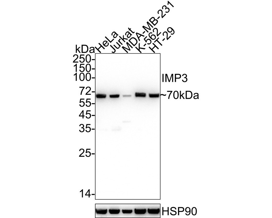 IGF2BP3 Antibody (JE34-04) Western Blot: IGF2BP3 Antibody (JE34-04) [NBP3-32471]