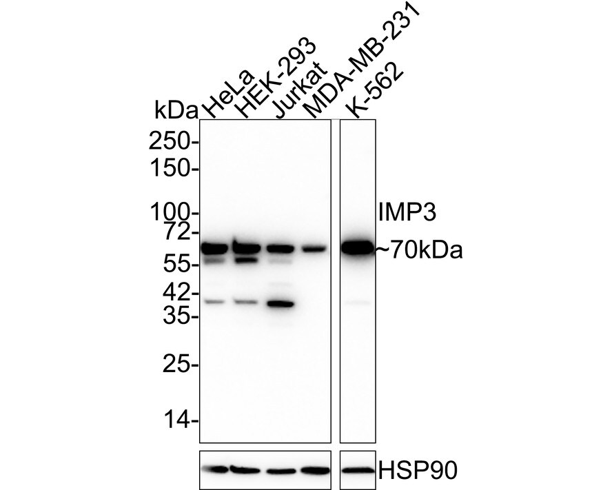 IGF2BP3 Antibody (JE34-04)