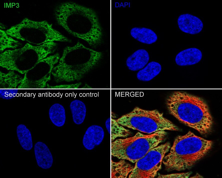 IGF2BP3 Antibody (JE34-04)