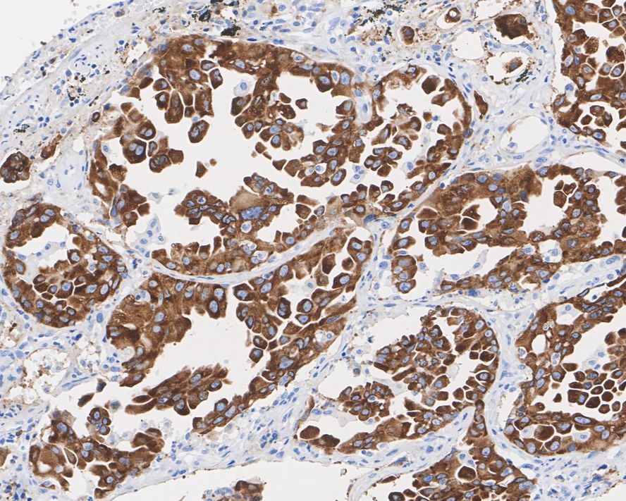 IGF2BP3 Antibody (JE34-04)