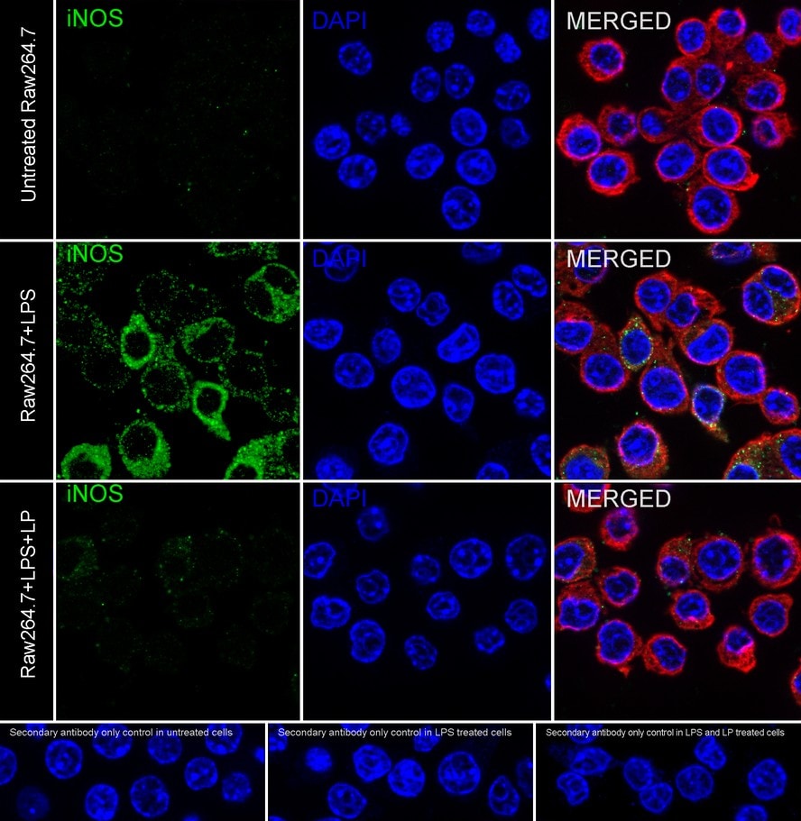 iNOS Antibody (PSH03-69)