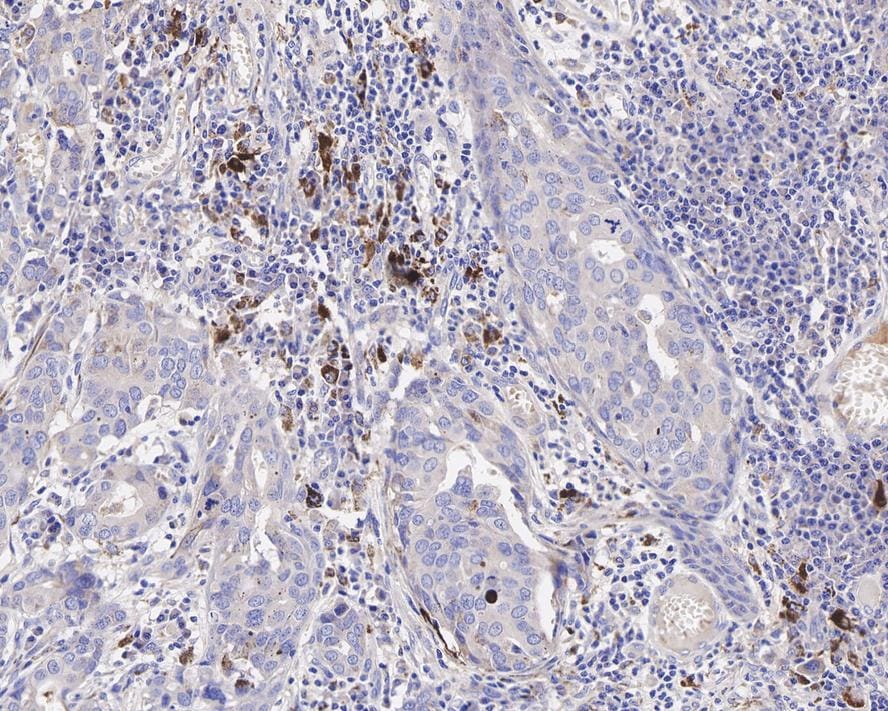 iNOS Antibody (PSH03-69)
